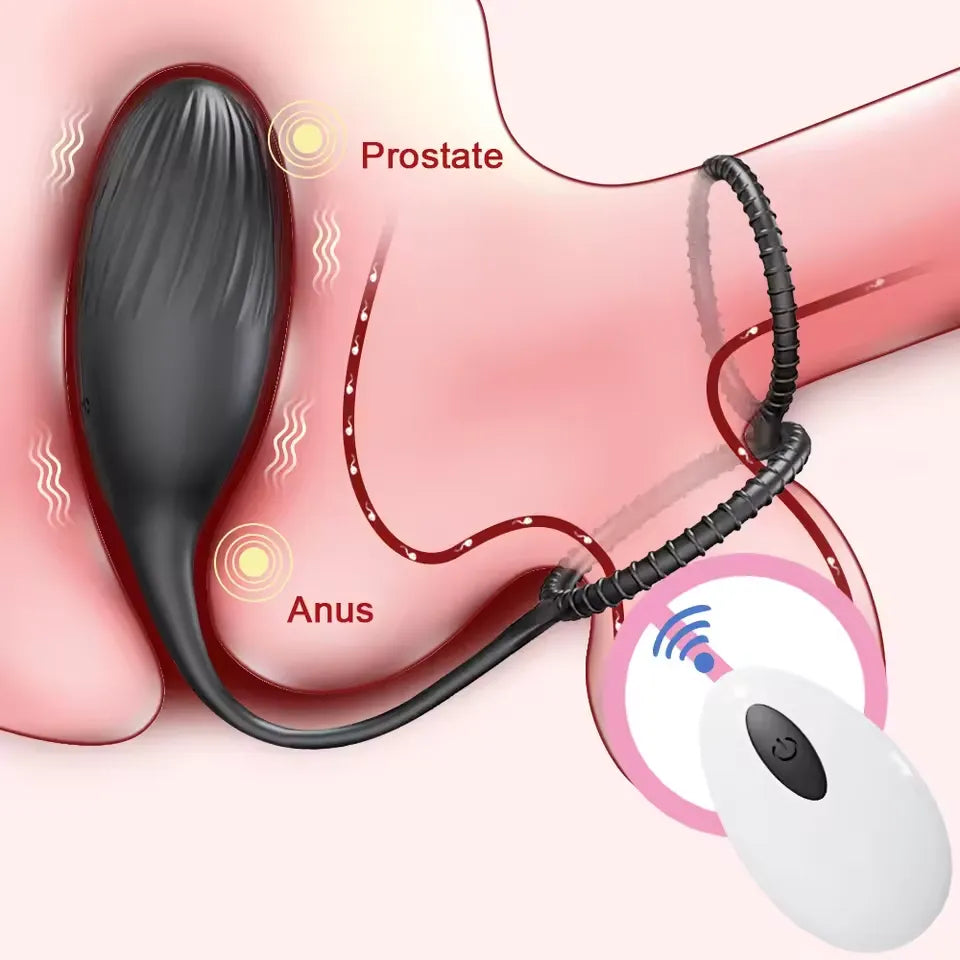 Remote Control Prostate Massager & Vibrating Butt Plug Cock Ring Combo